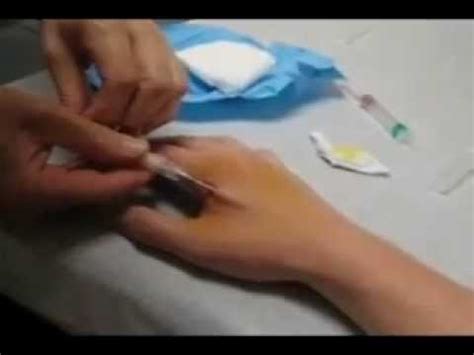 RFID CHIP PROCEDURE! OBAMA CARE 2014 